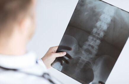 Lekarz diagnozuje naczyniaka kręgosłupa