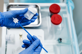 Wykonanie cytologii płynnej