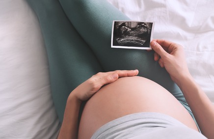 Kobieta w  ciąży patrząca na usg dziecka