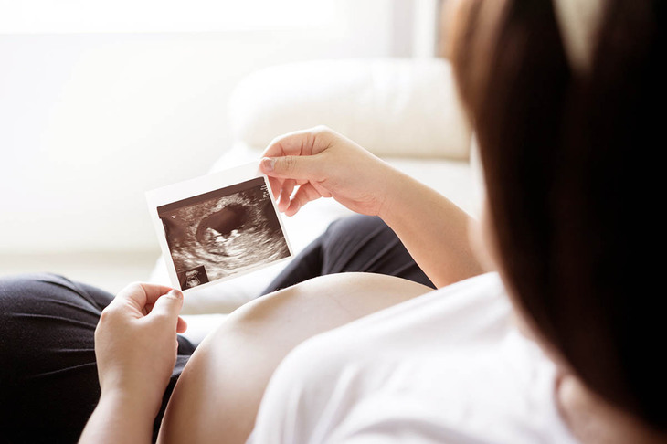 Kobieta patrząca na zdjęcie usg z dzieckiem