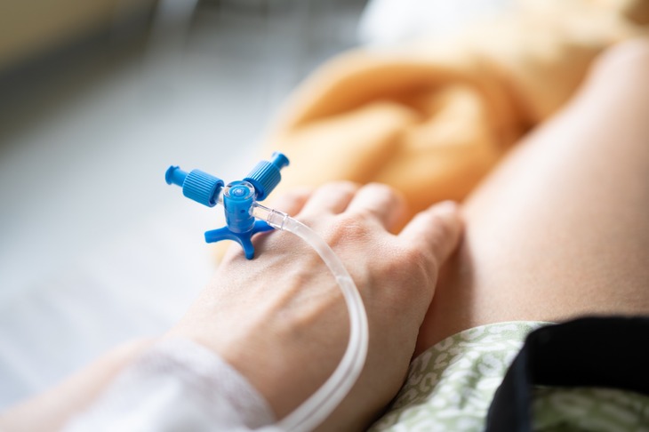 Kobieta po podaniu chemioterapii prewencyjnej