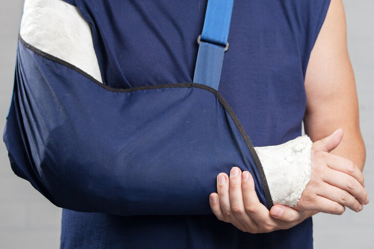 Na zdjęciu widzimy mężczyznę, który nosi gips i temblak na ramieniu z powodu złamania otwartego.