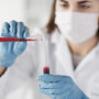 Próbki krwi w laboratorium